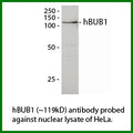 Anti-hBUB1 Antibody – Figure 1 of 1