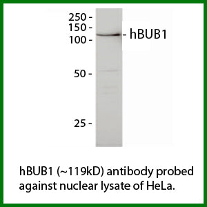 Anti-hBUB1 Antibody – Figure 1 of 1