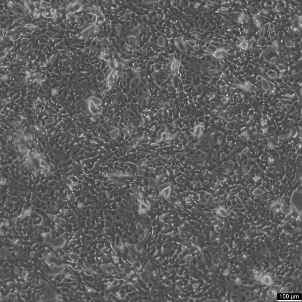 HC11 cell