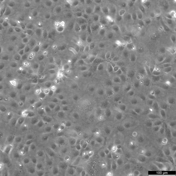 HCE-T cell