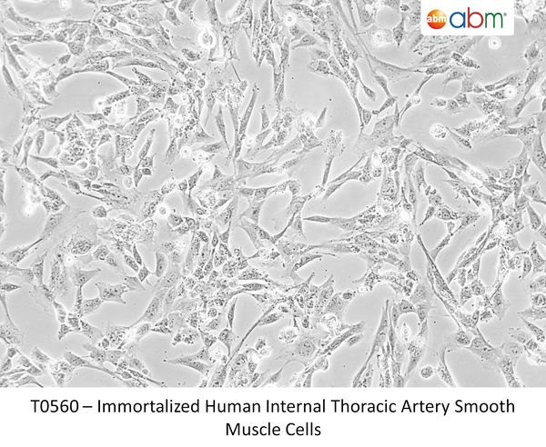 Immortalized Human Internal Thoracic Artery Smooth Muscle Cells – Figure 1 of 1