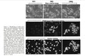 Huntingtin 150Q Stable PC12 Cell Line | Applied Biological Materials (abm)