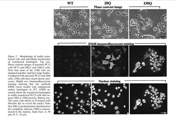 Huntingtin 150Q Stable PC12 Cell Line | Applied Biological Materials (abm)