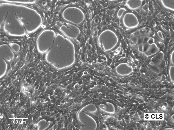 Hep-53.4 cell