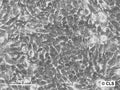 Hep-56.1B cell