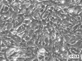 Hep-56.1C cell
