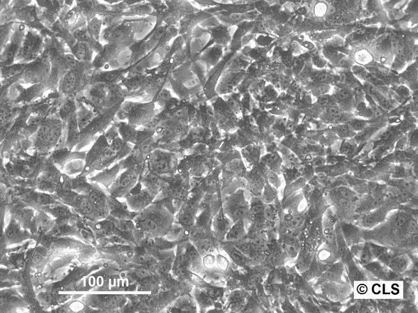Hep-56.1C cell