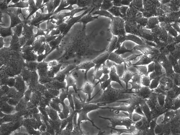 Hep-56.1D cell
