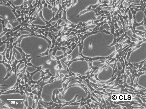 Hep-74.3A cell