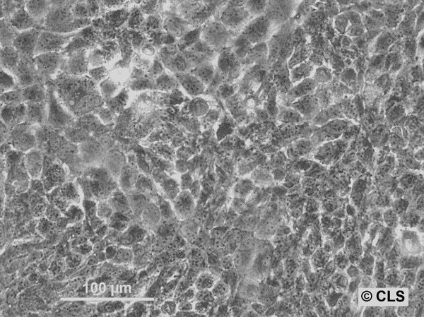 Hep-CLS-1H cell