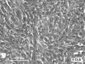 Hep-CLS-1W cell