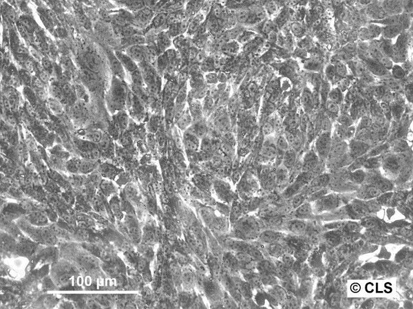 Hep-CLS-1W cell
