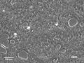 Hep-CLS-E1 cell