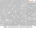 Immortalized Human Pulmonary Fibroblast Cells – Figure 1 of 1