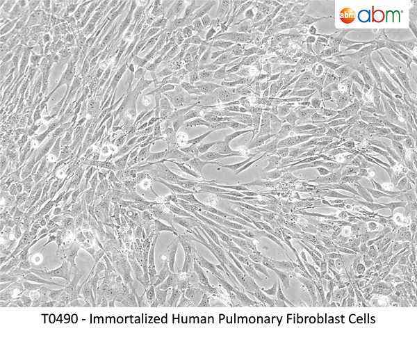 Immortalized Human Pulmonary Fibroblast Cells – Figure 1 of 1