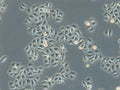 HK-ZFN-AURKB-mEGFP cell