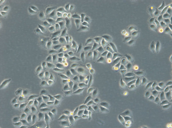 HK-ZFN-AURKB-mEGFP cell