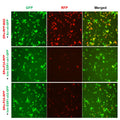 h/m ESR1 shRNA Lentivirus – Figure 1