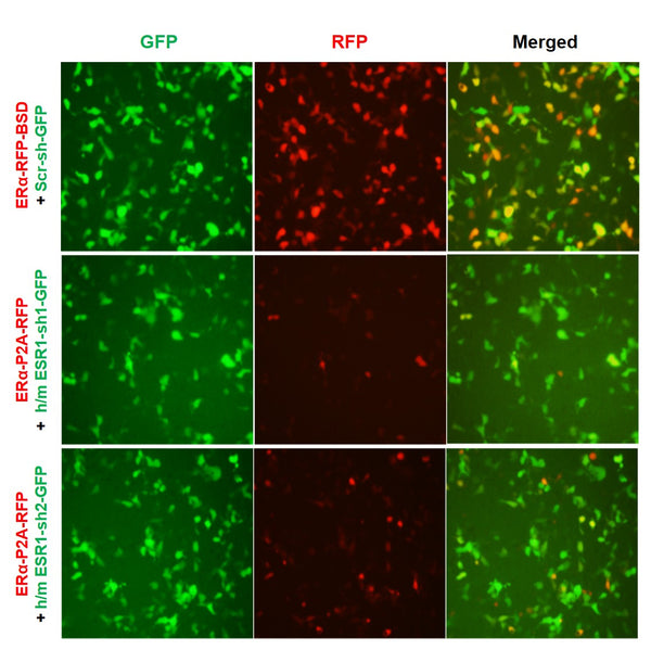 h/m ESR1 shRNA Lentivirus – Figure 1