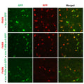 h/m FASN shRNA Lentivirus – Figure 1 of 3