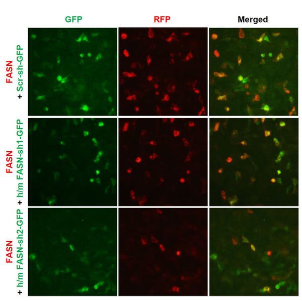 h/m FASN shRNA Lentivirus – Figure 1 of 3
