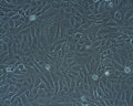 HOS cell