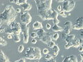 HROC113 cell