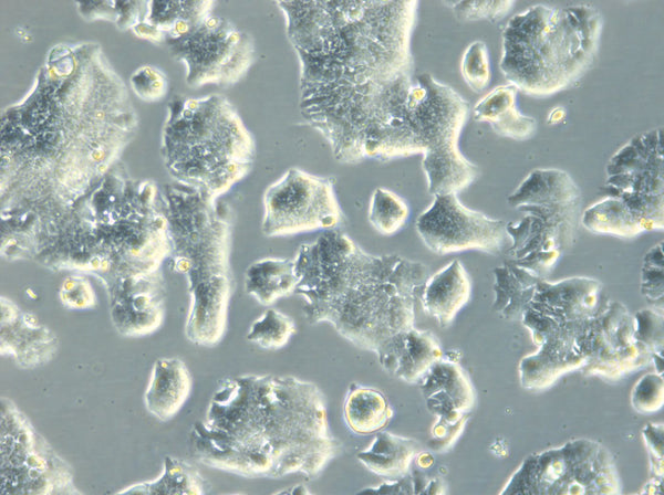 HROC113 cell