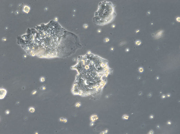 HROC126 cell