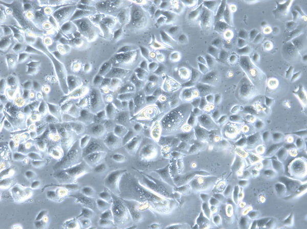 HROC173 cell