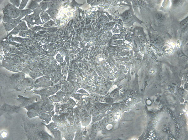 HROC18 cell