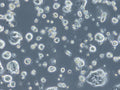 HROC183 cell