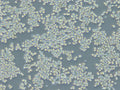 HROC212 cell