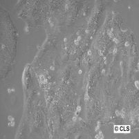 HROC239 T0 M1 cell – Figure 1 of 1