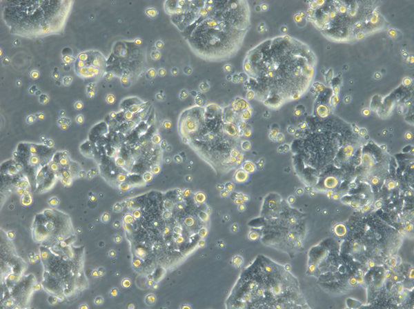 HROC257 cell
