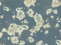 HROC278Met1 T2 M2 cell