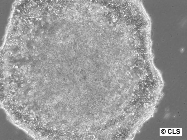HROC296 cell