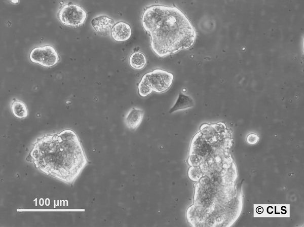 HROC374 cell
