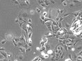HROC383 cell