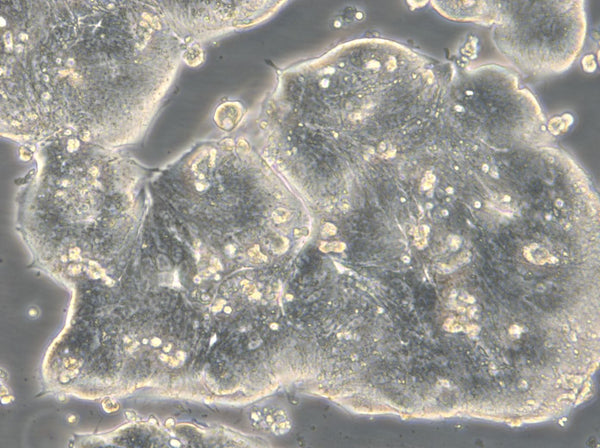 HROC39 cell