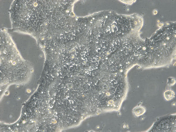 HROC40 cell