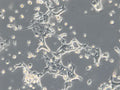 HROC69 cell