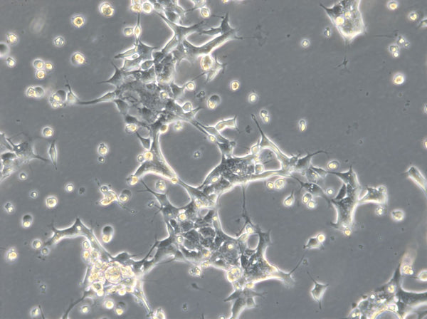 HROC69 cell