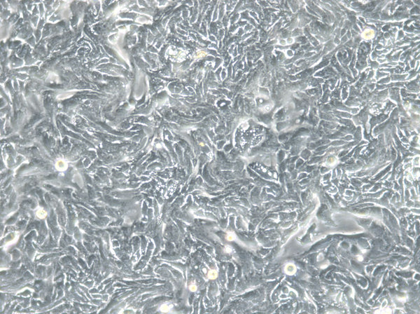 HROC80 T1 M1 cell