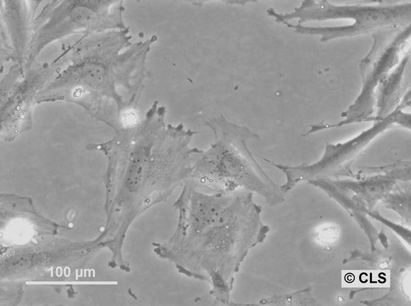 HROG02 cell