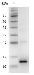 Human CCL2 Protein, His tag (Animal-Free)