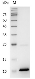 Human CXCL10 Protein, His tag (Animal-Free)