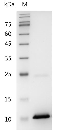 Human CXCL10 Protein, His tag (Animal-Free)