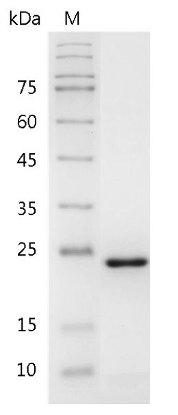 Human FGF-21 Protein, His tag (Animal-Free)