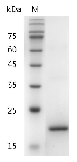 Human G-CSF Protein, His tag (Animal-Free)